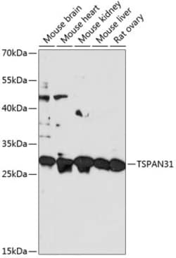 Invitrogen TSPAN31 Polyclonal Antibody 100 &mu;L; Unconjugated:Antibodies,