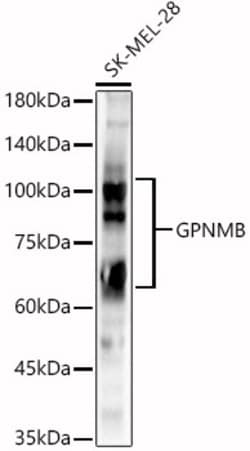 Invitrogen GPNMB Polyclonal Antibody 100 &mu;L; Unconjugated:Antibodies,