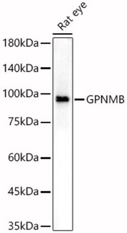 Invitrogen GPNMB Polyclonal Antibody 100 &mu;L; Unconjugated:Antibodies,