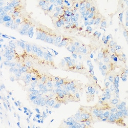 Invitrogen MAN1A2 Polyclonal Antibody 100 &mu;L | Buy Online | Invitrogen&trade; | Fisher Scientific