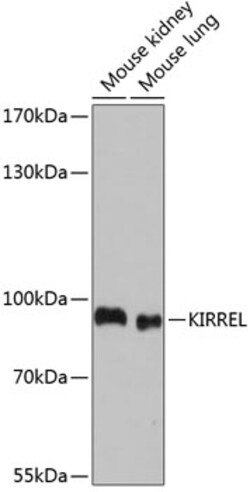 Invitrogen KIRREL Polyclonal Antibody 100 &mu;L; Unconjugated:Antibodies,