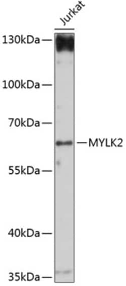 Invitrogen MYLK2 Polyclonal Antibody 100 &mu;L | Buy Online | Invitrogen&trade; | Fisher Scientific