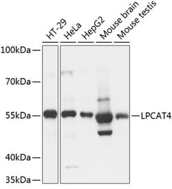 Invitrogen LPCAT4 Polyclonal Antibody 100 &mu;L; Unconjugated:Antibodies,
