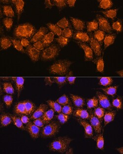 Invitrogen RABL3 Polyclonal Antibody 100 &mu;L; Unconjugated:Antibodies,