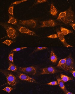 Invitrogen RABL3 Polyclonal Antibody 100 &mu;L; Unconjugated:Antibodies,
