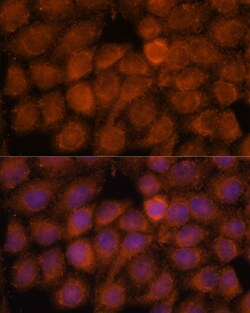 Invitrogen NDUFAF4 Polyclonal Antibody 100 &mu;L; Unconjugated:Antibodies,