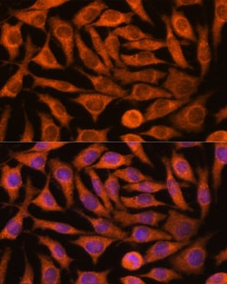 Invitrogen NDUFAF4 Polyclonal Antibody 100 &mu;L; Unconjugated:Antibodies,