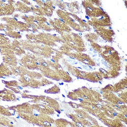 Invitrogen NDUFAF4 Polyclonal Antibody 100 &mu;L; Unconjugated:Antibodies,