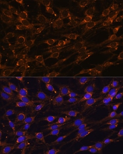 Invitrogen PREPL Polyclonal Antibody 100 &mu;L; Unconjugated:Antibodies,