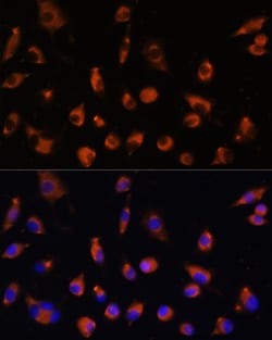 Invitrogen TMEM25 Polyclonal Antibody 100 &mu;L; Unconjugated:Antibodies,