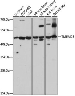 Invitrogen TMEM25 Polyclonal Antibody 100 &mu;L; Unconjugated:Antibodies,