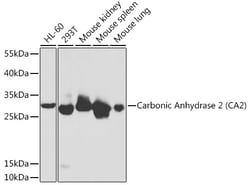 Invitrogen Carbonic Anhydrase II Polyclonal Antibody 100 &mu;L; Unconjugated:Antibodies,