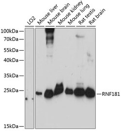 Invitrogen RNF181 Polyclonal Antibody 100 &mu;L; Unconjugated:Antibodies,