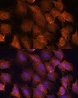 Invitrogen SCRN3 Polyclonal Antibody 100 &mu;L; Unconjugated:Antibodies,