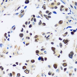 Invitrogen ASCL4 Polyclonal Antibody 100 &mu;L; Unconjugated:Antibodies,