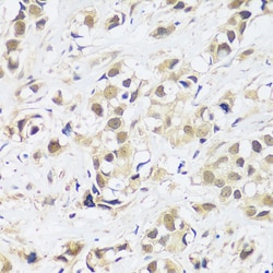Invitrogen ASCL4 Polyclonal Antibody 100 &mu;L; Unconjugated:Antibodies,