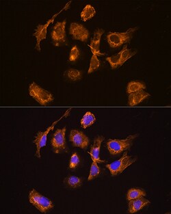 Invitrogen TRH Polyclonal Antibody 100 &mu;L; Unconjugated:Antibodies,