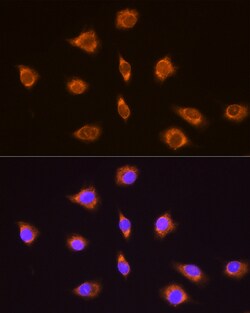 Invitrogen TRH Polyclonal Antibody 100 &mu;L; Unconjugated:Antibodies,