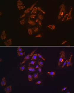 Invitrogen TRH Polyclonal Antibody 100 &mu;L; Unconjugated:Antibodies,