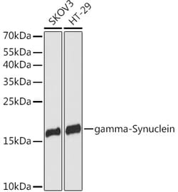 Invitrogen gamma Synuclein Polyclonal Antibody 100 &mu;L; Unconjugated:Antibodies,