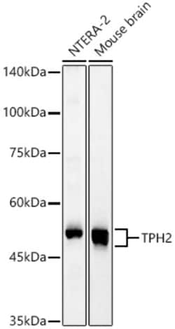 Invitrogen TPH2 Polyclonal Antibody 100 &mu;L; Unconjugated:Antibodies,