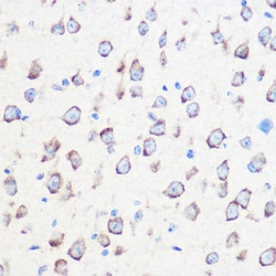 Invitrogen Calmodulin 3 Polyclonal Antibody 100 &mu;L; Unconjugated:Antibodies,