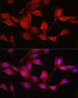 Invitrogen GSS Polyclonal Antibody 100 &mu;L | Buy Online | Invitrogen&trade; | Fisher Scientific