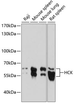 Invitrogen HCK Polyclonal Antibody 100 &mu;L; Unconjugated:Antibodies,