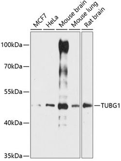 TUBG1 Polyclonal Antibody, Invitrogen 100 &mu;L; Unconjugated:Antibodies,