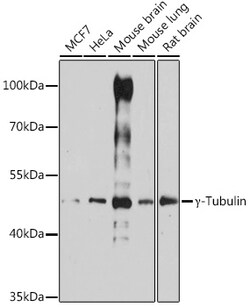 TUBG1 Polyclonal Antibody, Invitrogen 100 &mu;L; Unconjugated:Antibodies,