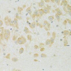 Invitrogen SLC37A4 Polyclonal Antibody 100 &mu;L; Unconjugated:Antibodies,