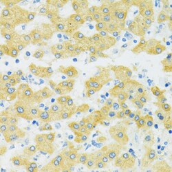 Invitrogen SLC37A4 Polyclonal Antibody 100 &mu;L; Unconjugated:Antibodies,