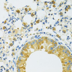 Invitrogen SLC37A4 Polyclonal Antibody 100 &mu;L; Unconjugated:Antibodies,