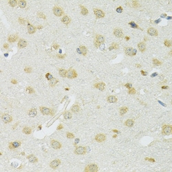 Invitrogen SLC37A4 Polyclonal Antibody 100 &mu;L; Unconjugated:Antibodies,