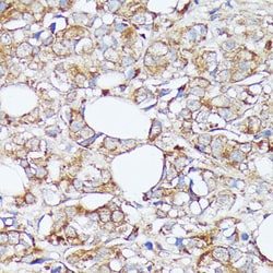 Invitrogen SLC7A2 Polyclonal Antibody 100 &mu;L | Buy Online | Invitrogen&trade; | Fisher Scientific