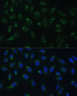 Invitrogen HIGD1A Polyclonal Antibody 100 &mu;L; Unconjugated:Antibodies,