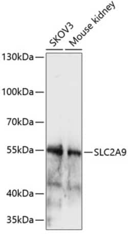 GLUT9 Polyclonal Antibody:Antibodies, Polyclonal