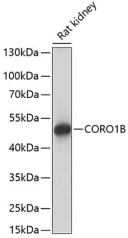 Invitrogen Coronin 1B Polyclonal Antibody 100 &mu;L; Unconjugated:Antibodies,