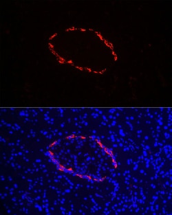 Glucagon Polyclonal Antibody:Antibodies, Polyclonal