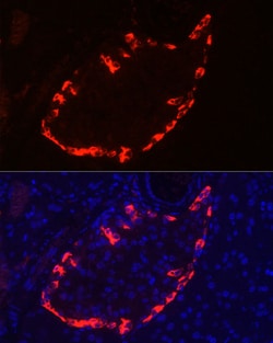 Glucagon Polyclonal Antibody:Antibodies, Polyclonal