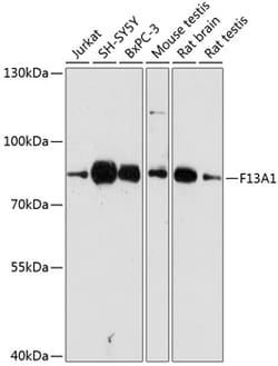 Factor XIII A Polyclonal Antibody:Antibodies, Polyclonal