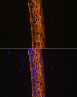 Invitrogen MYH13 Polyclonal Antibody 100 &mu;L | Buy Online | Invitrogen&trade; | Fisher Scientific