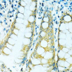 Invitrogen CYP2B6 Polyclonal Antibody 100 &mu;L; Unconjugated:Antibodies,