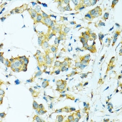 Invitrogen CYP2B6 Polyclonal Antibody 100 &mu;L; Unconjugated:Antibodies,