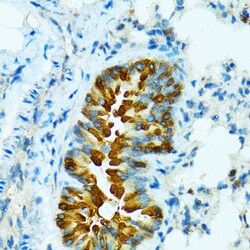 Invitrogen CYP2B6 Polyclonal Antibody 100 &mu;L; Unconjugated:Antibodies,
