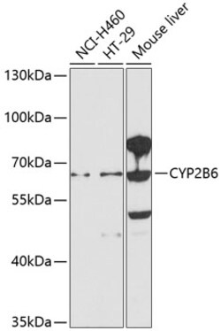 Invitrogen CYP2B6 Polyclonal Antibody 100 &mu;L; Unconjugated:Antibodies,