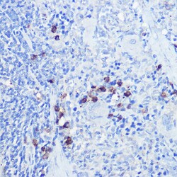 Invitrogen TLR9 Polyclonal Antibody 100 &mu;L; Unconjugated:Antibodies,