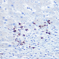 Invitrogen TLR9 Polyclonal Antibody 100 &mu;L; Unconjugated:Antibodies,