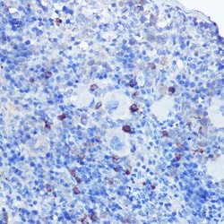 Invitrogen TLR9 Polyclonal Antibody 100 &mu;L; Unconjugated:Antibodies,