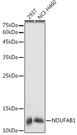 NDUFAB1 Polyclonal Antibody:Antibodies, Polyclonal